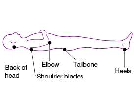 A line drawing of a person laying on their back showing at risk pressure injury points on the back of head, shoulder blades, elbow, tailbone and heels