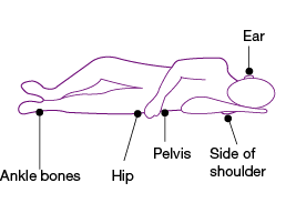 A line drawing of a person laying on side showing at risk pressure injury points on the ear, side of shoulder, pelvis, hip and ankle bones.